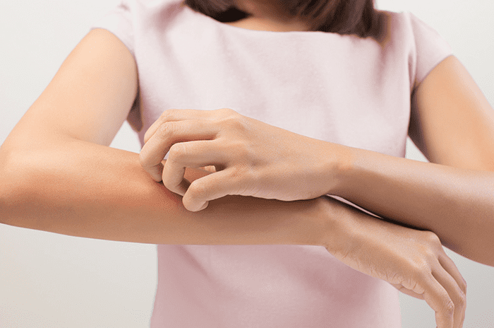 penyebab alergi kulit dan cara penanganan